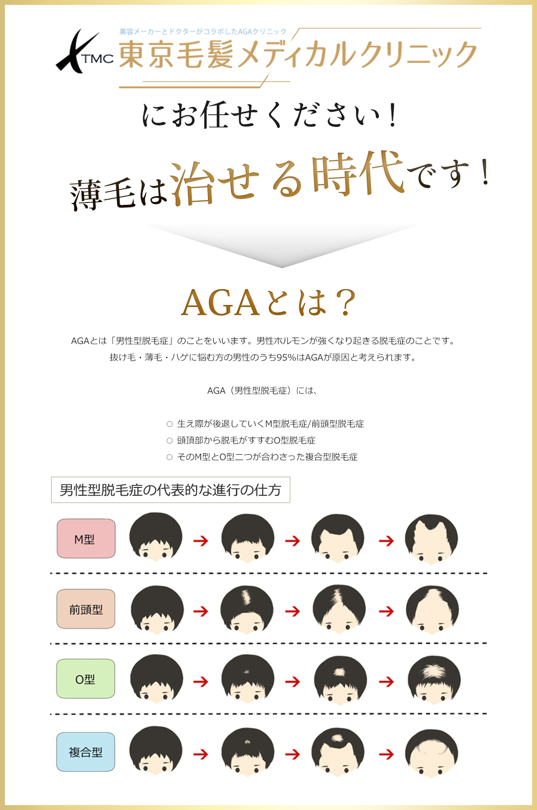 薄毛は治せる時代です!